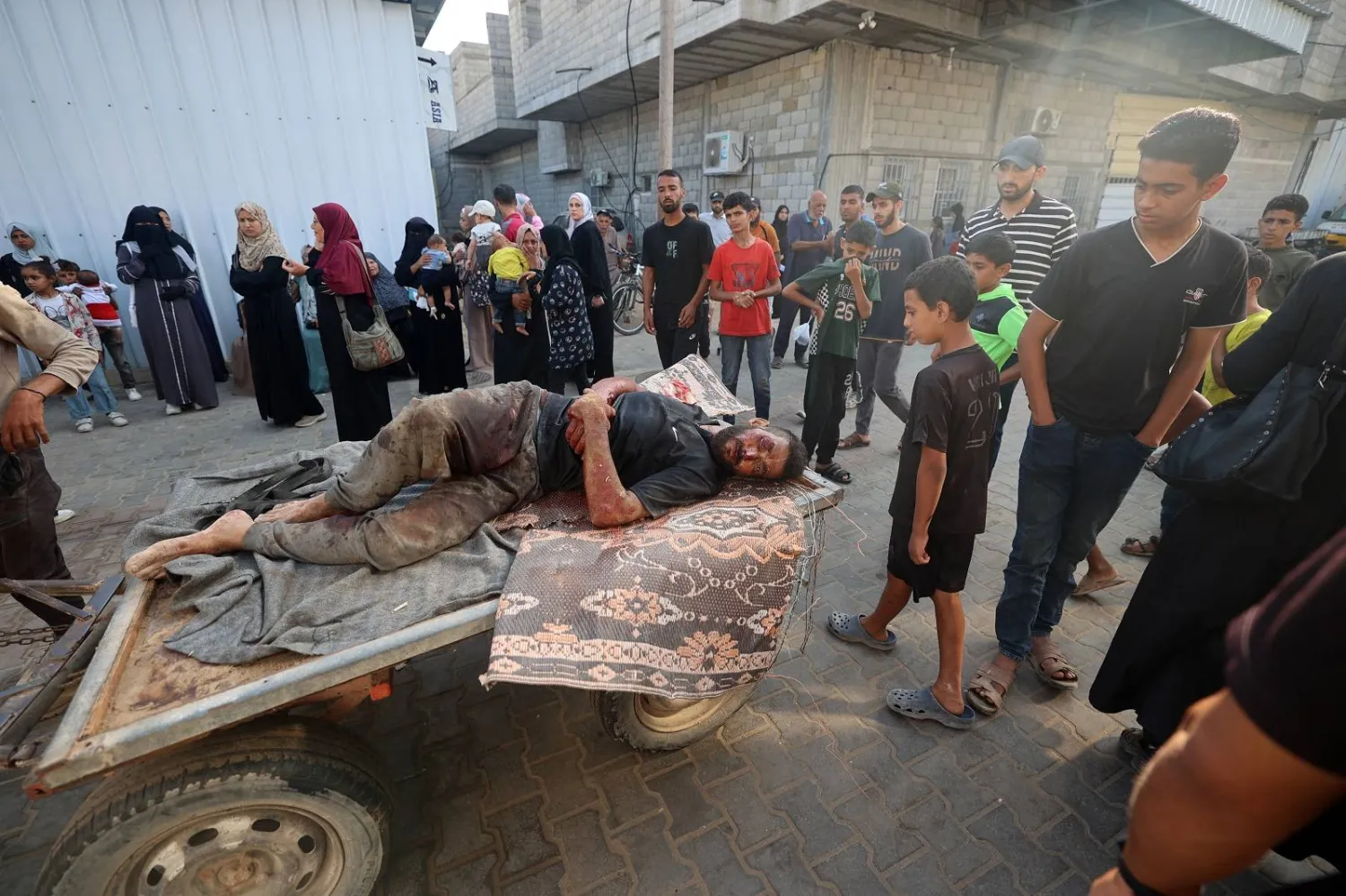 أحد ضحايا القصف الإسرائيلي خلال نقله إلى «مستشفى العودة» في مخيم النصيرات للاجئين (أ.ف.ب)