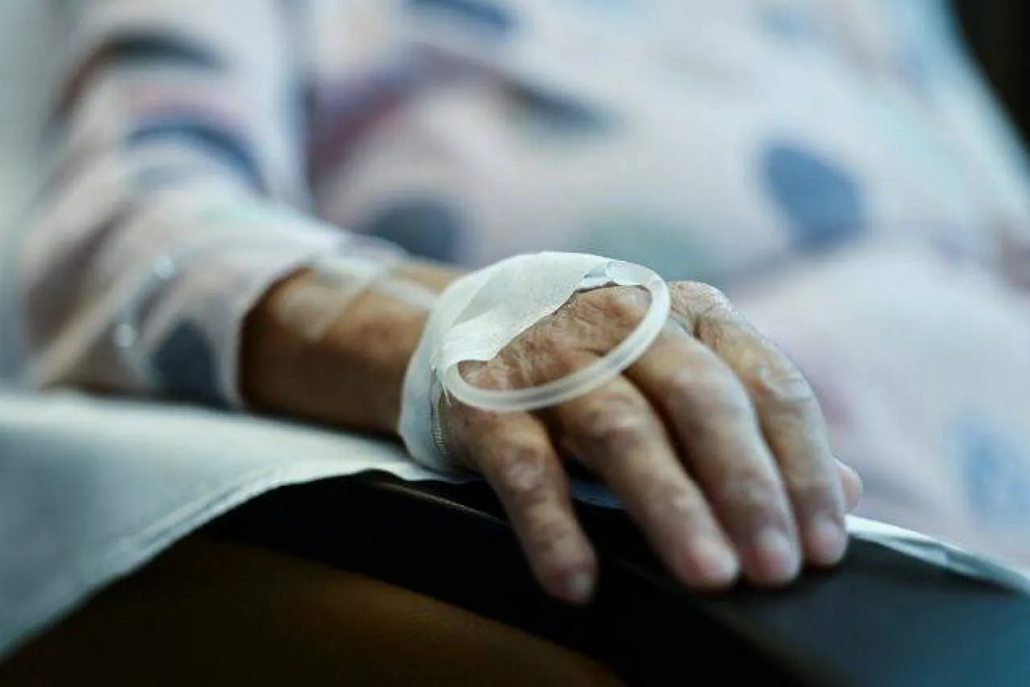 يعدّ سرطان الجلد من أكثر أنواع السرطان انتشاراً على مستوى العالم (رويترز)