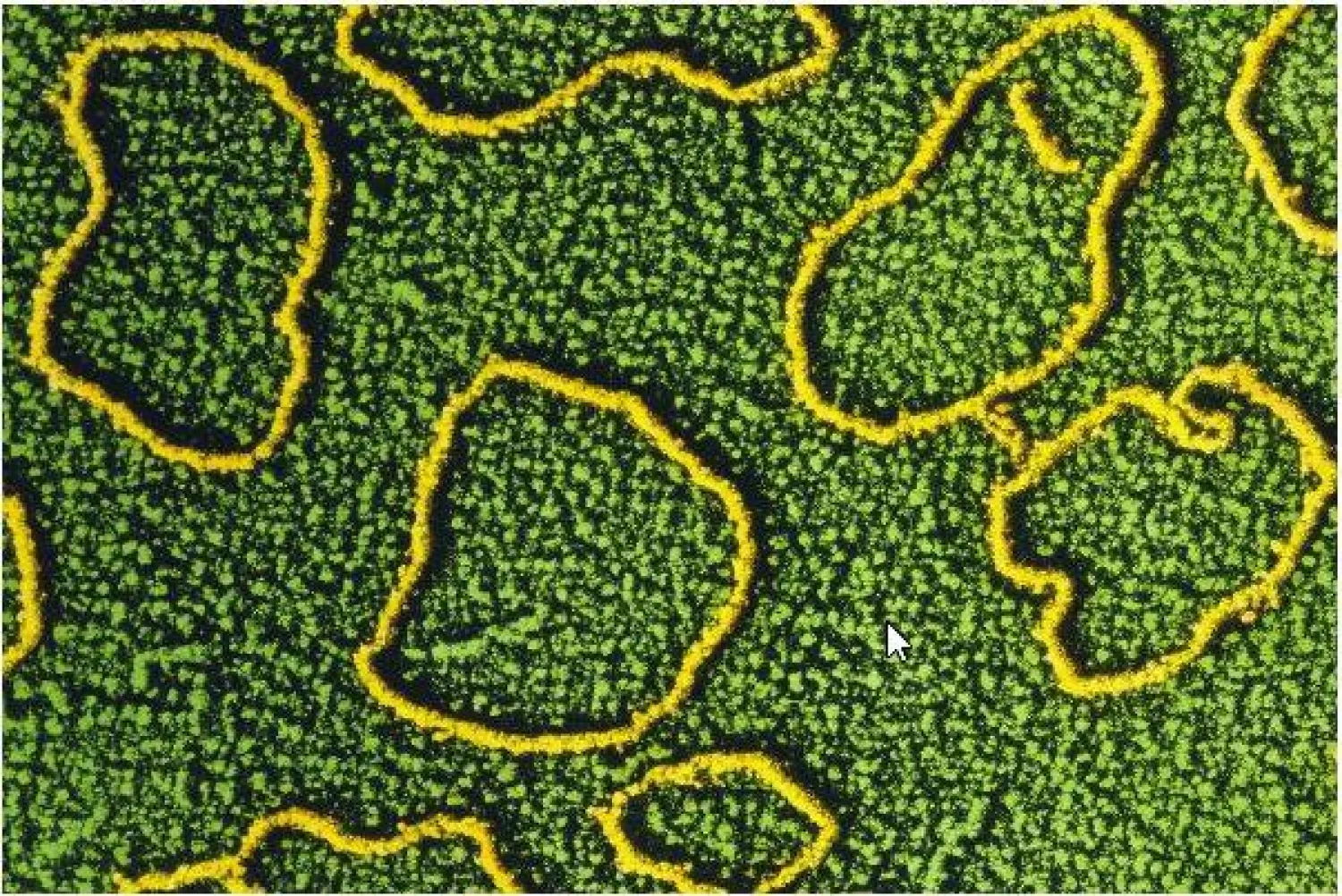 لقطة لامتدادات الحمض النووي للبكتريا الاشريكية القولونية تحت المجهر