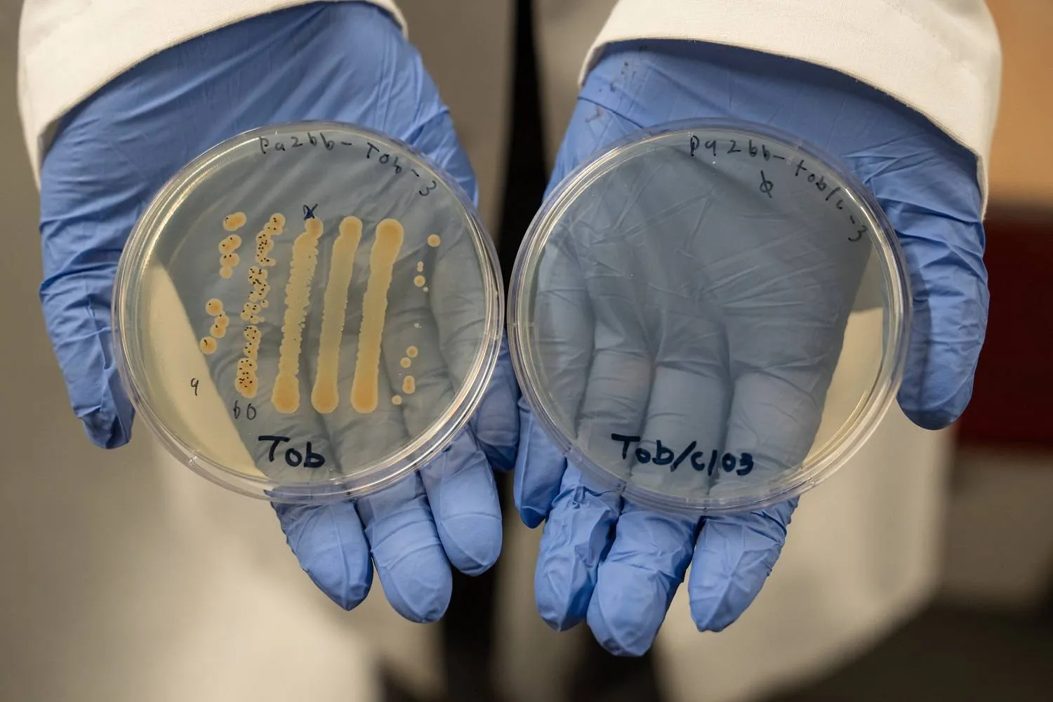 المزيج الدوائي الجديد يعزز قوة المضادات الحيوية ضد البكتيريا بمقدار 10 آلاف مرة (جامعة أوريغون)