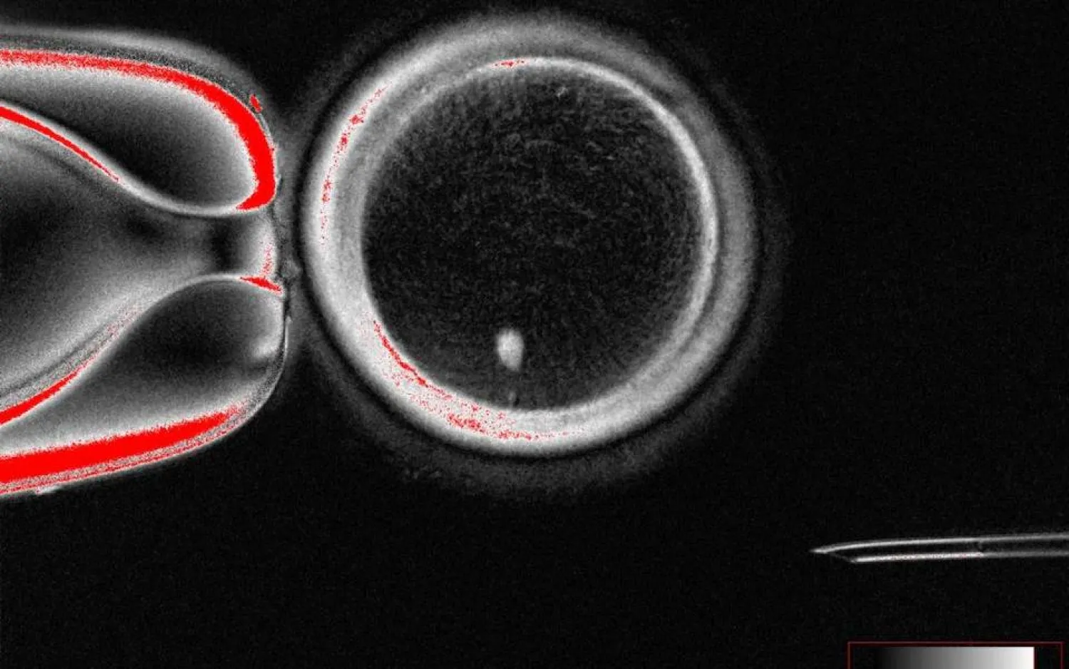 بويضة بشرية وظيفية - النقطة المضيئة هي النواة المنقولة لخلية جلدية (مختبر «ميتاليبوف»)