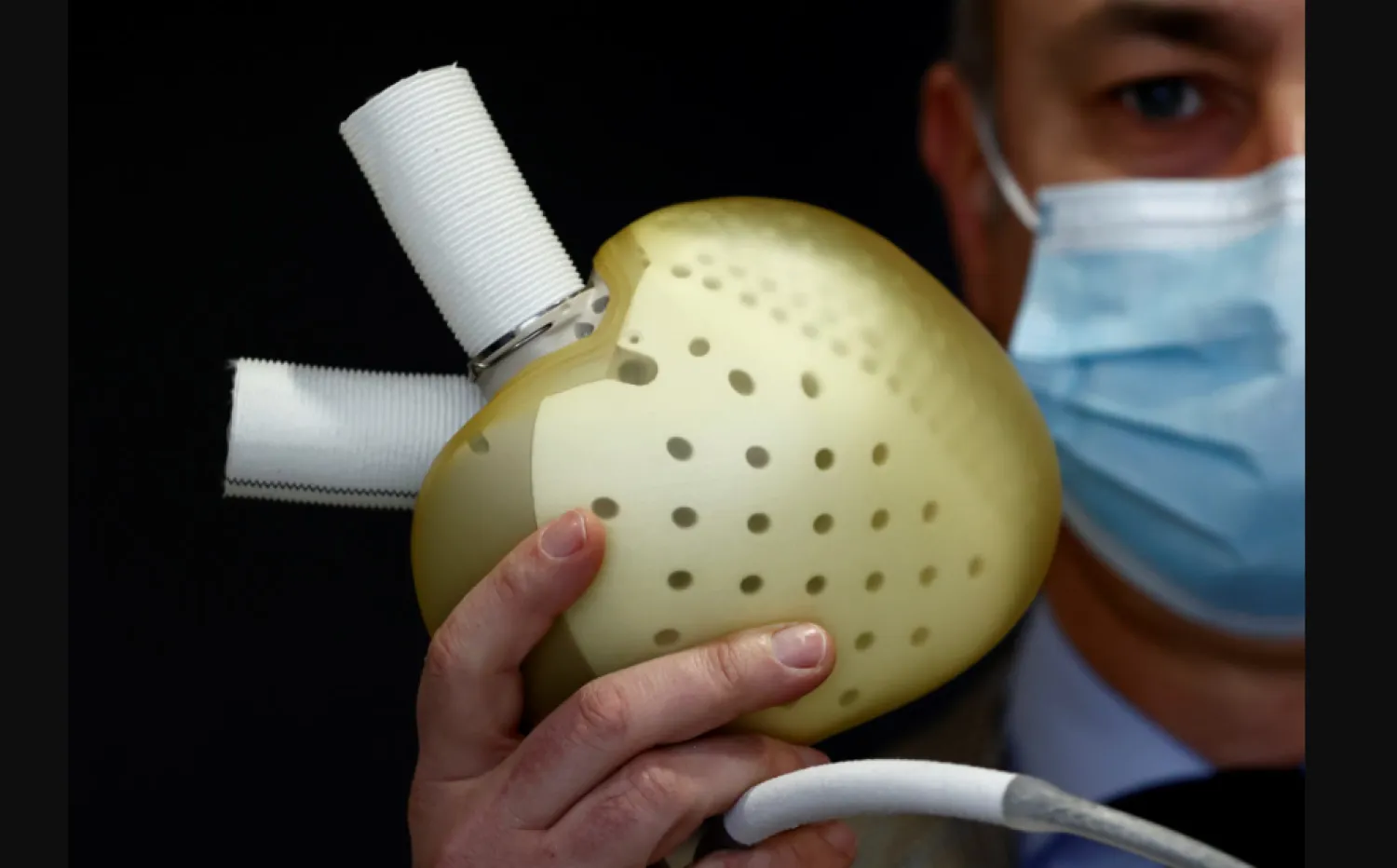 الدوار والتعرق البارد أو الغثيان المفاجئ من الأعراض الجسدية للنوبة القلبية (رويترز)