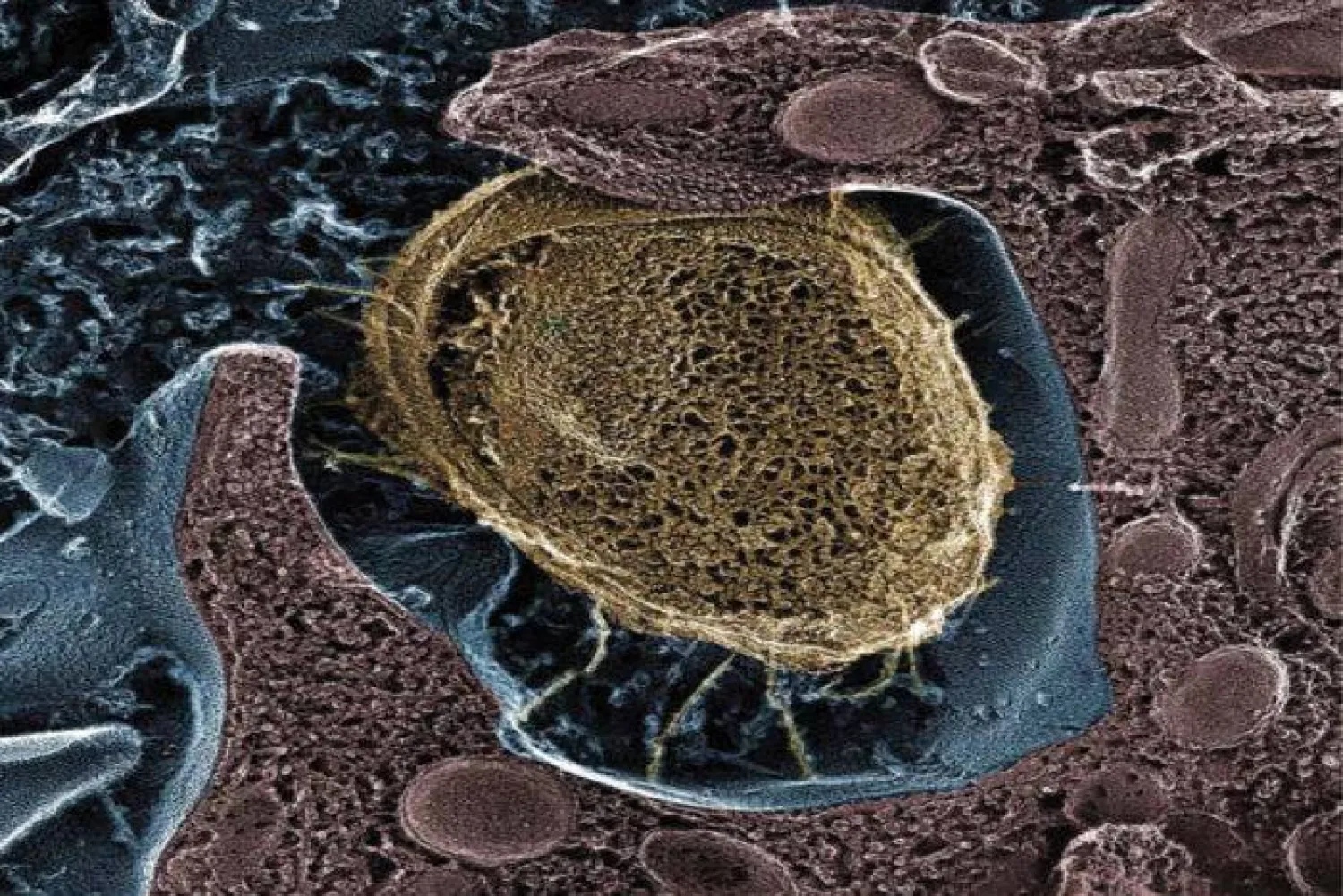 عدوى المسالك البولية من الأكثر شيوعاً (جامعة واشنطن)