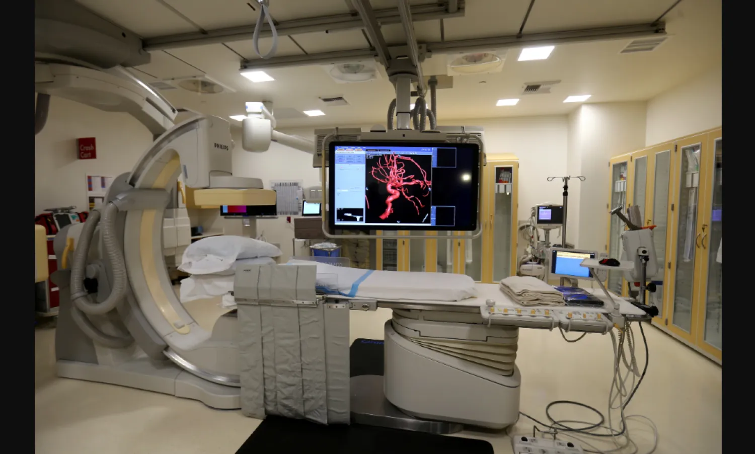 العلاج الإشعاعي يستخدم حزماً من الطاقة المكثفة لقتل الخلايا السرطانية (رويترز)