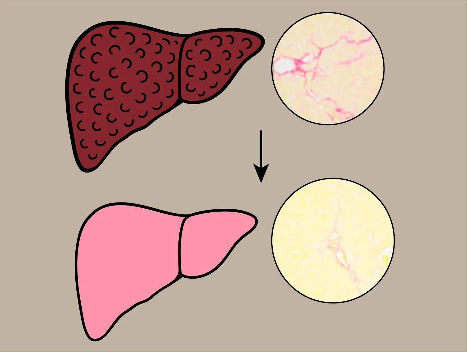 مركب طبيعي في الحناء قد يُصلح أنسجة الكبد التالفة (جامعة أوساكا متروبوليتان)