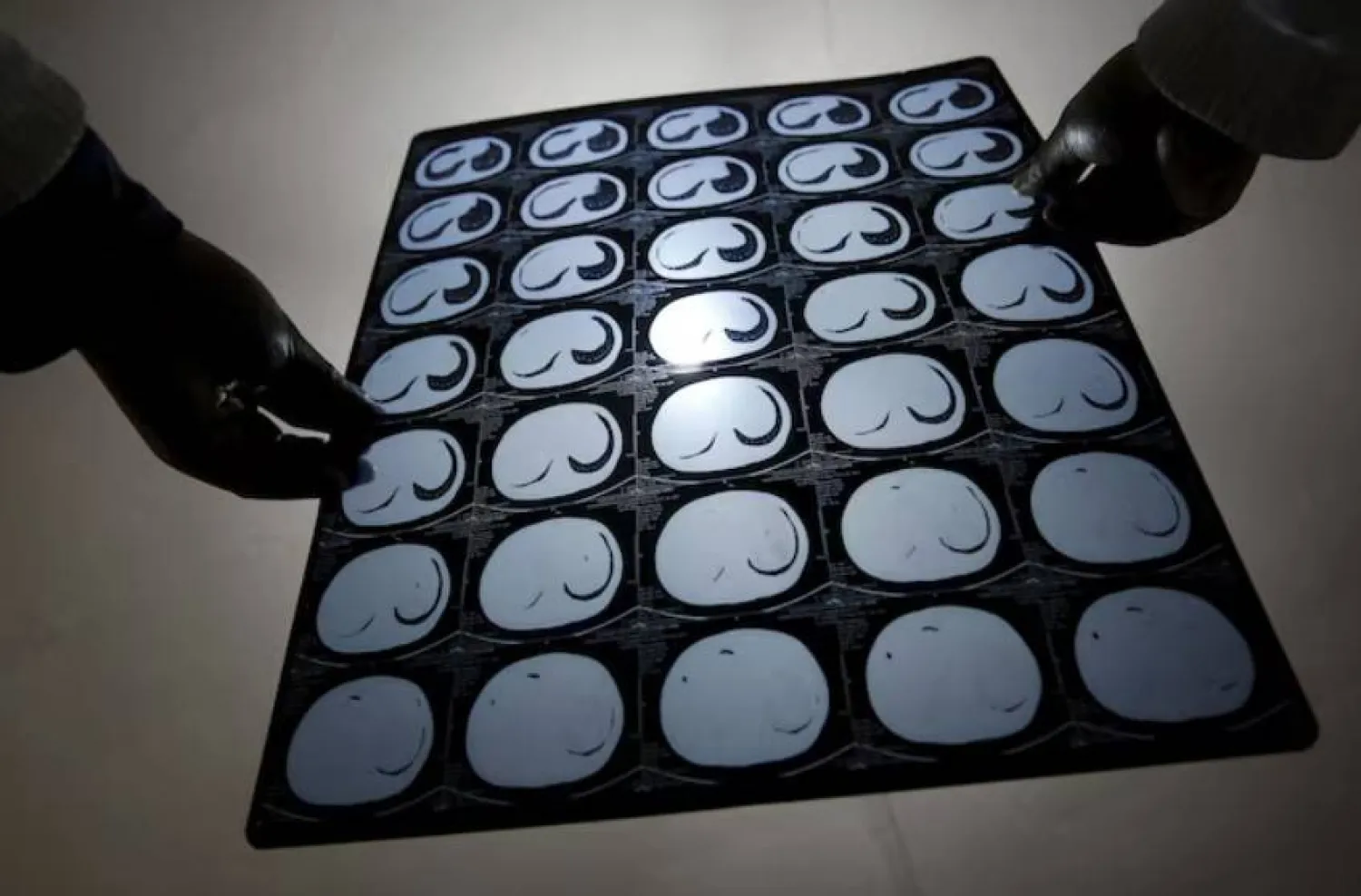 صور أشعة مقطعية للأمعاء (أرشيفية - رويترز)