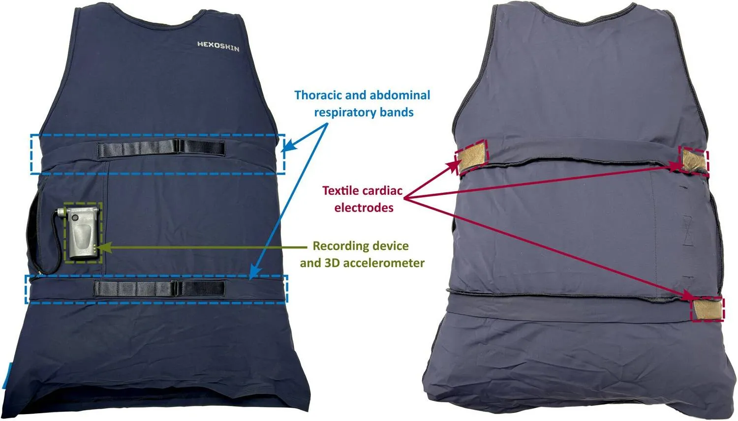 القميص الذكي مزوَّد بمجموعة من الحساسات الدقيقة لرصد نوبات الصرع (دورية Epilepsia Open)