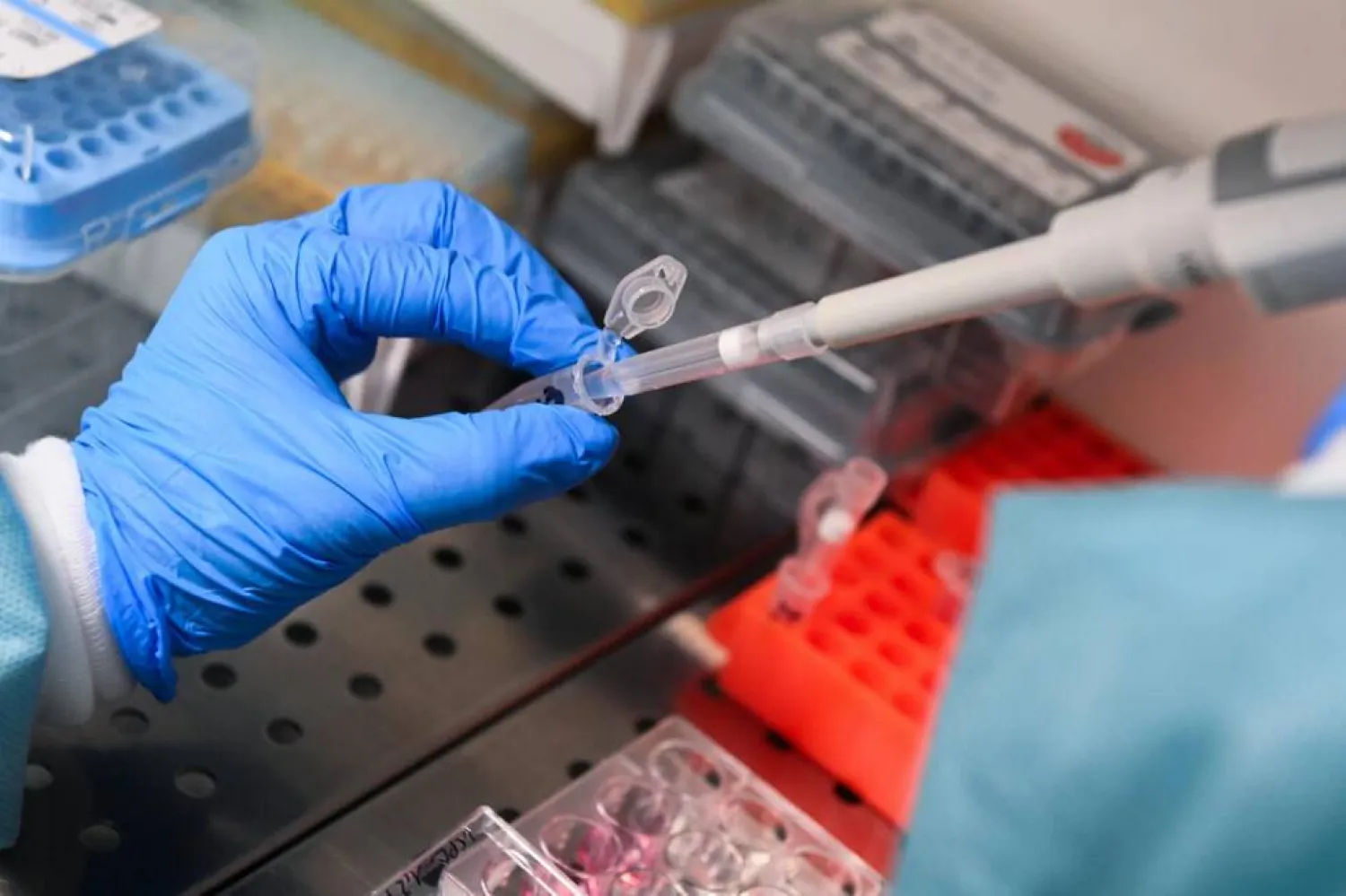 While mRNA was discovered in the early 1960s, it rose to global prominence when it was used in some Covid vaccines. JEAN-FRANCOIS MONIER / AFP
