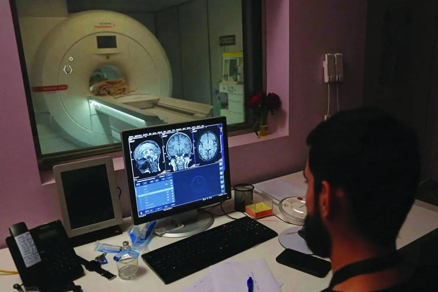 تتدهور وظيفة نظام التخلص من النفايات في الدماغ مع تكرار صدمات الرأس (أ.ف.ب)