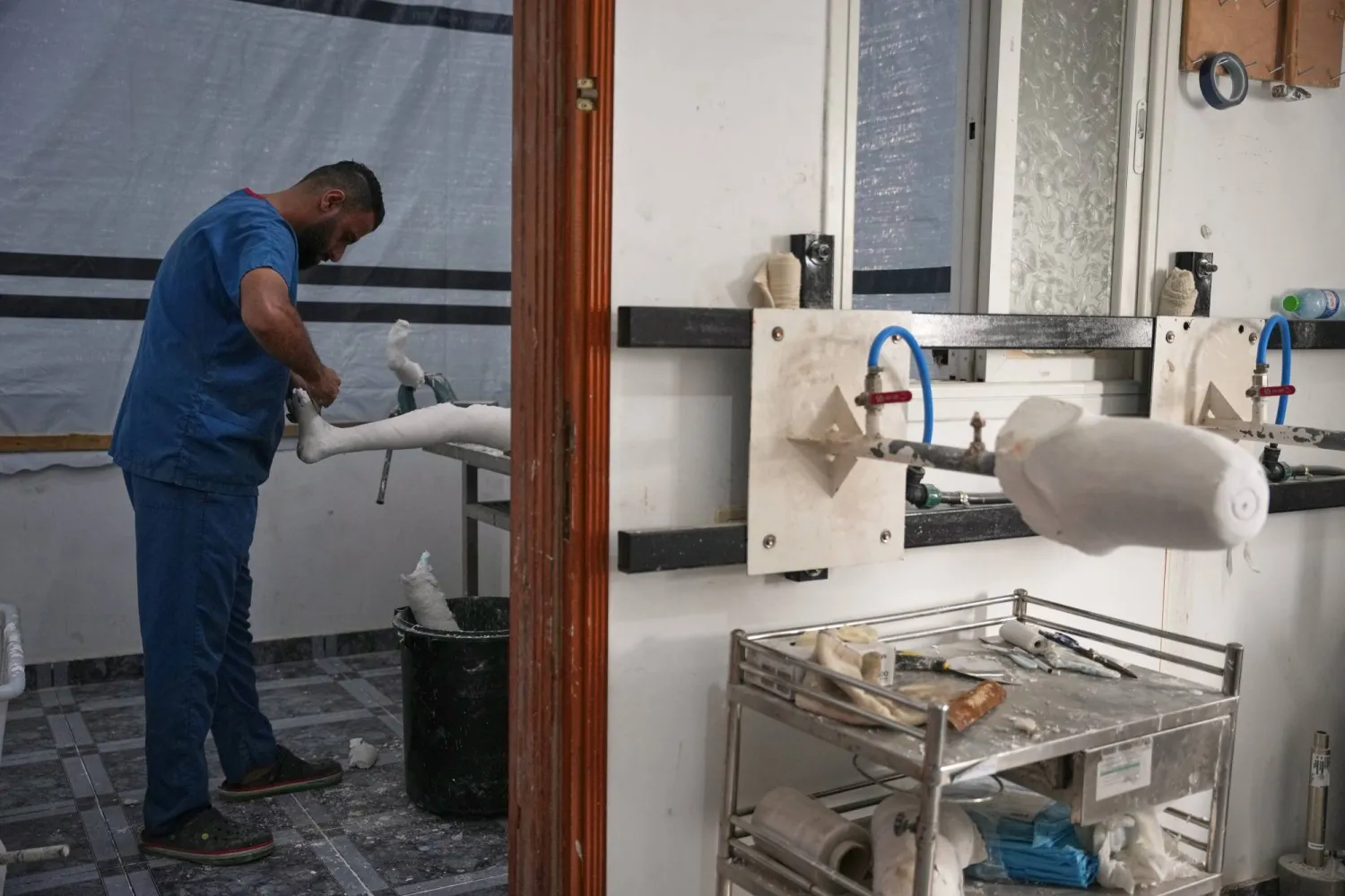 Prosthetic limb technician Ahmed Al-Ashqar, 34, prepares a leg amputation splint in the first stage of building an artificial leg at Hamad Hospital in Zawaida, central Gaza Strip, Thursday, Nov. 27, 2025. (AP Photo/Abdel Kareem Hana)

