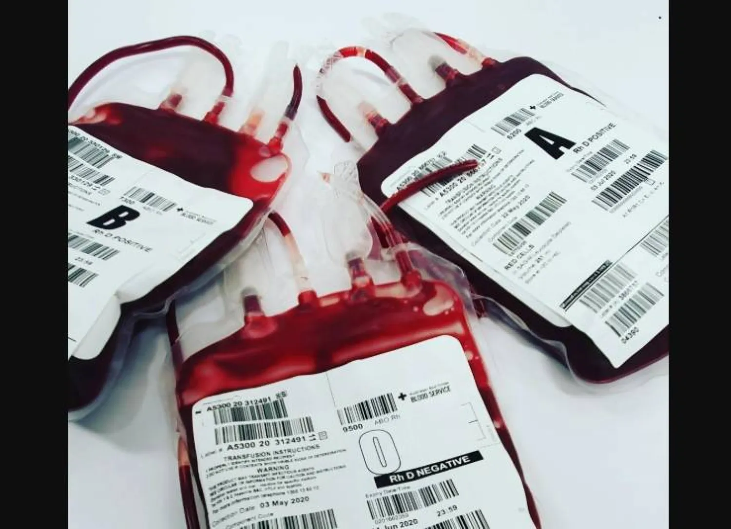 التأكد من فصيلة دمك ممكن عبر فحص تجريه لدى الطبيب أو أثناء التبرع بالدم (بيكسلز)