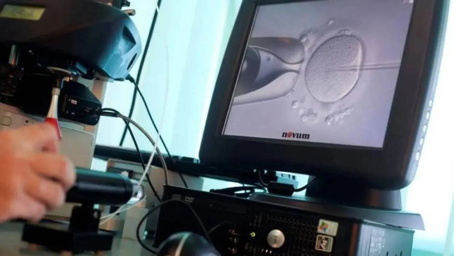 Egg quality is the primary cause of IVF failure and miscarriage in older women (Reuters) 