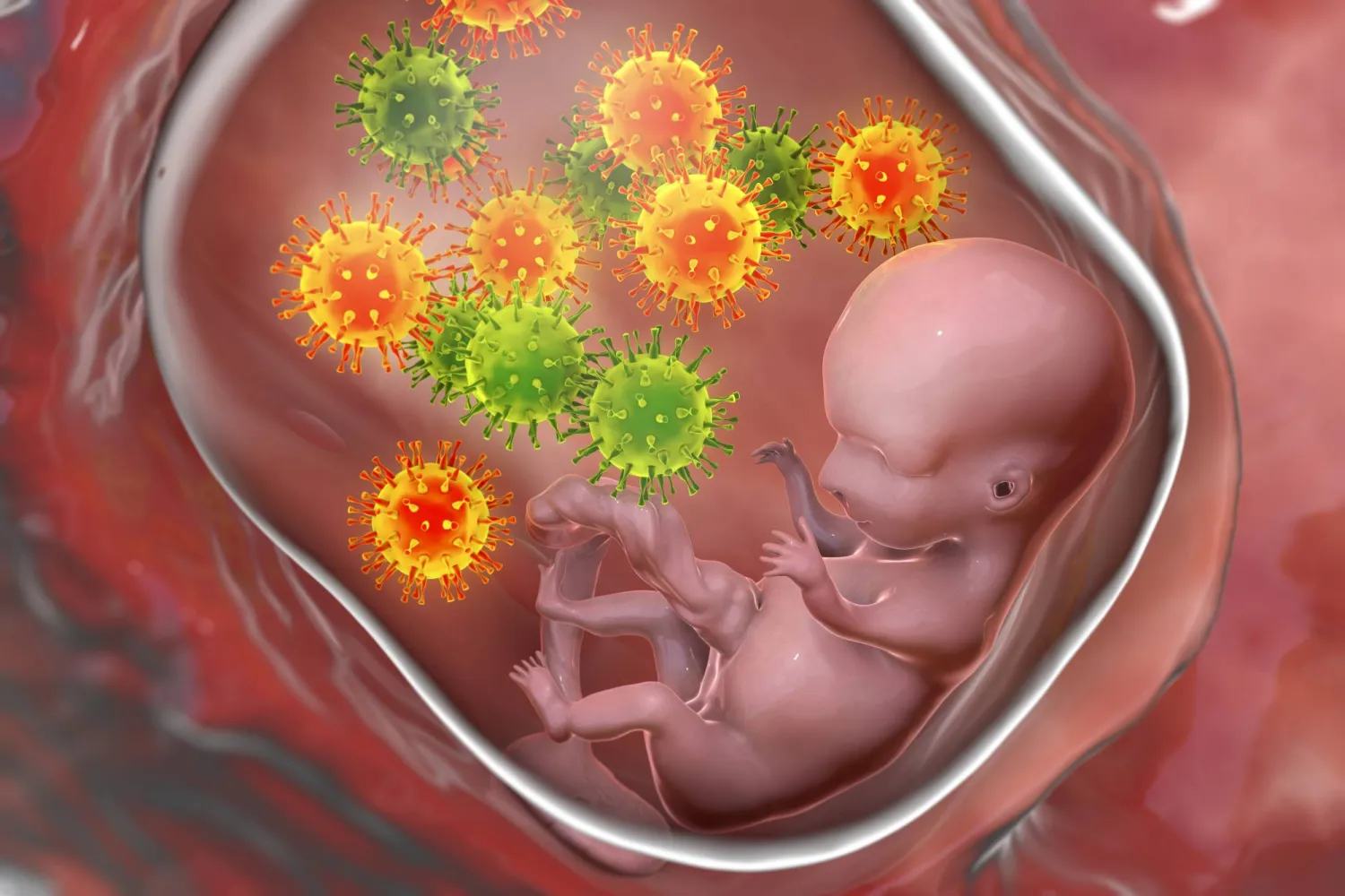 شكل تصويري لانتقال الفيروس المضخم للخلايا عبر المشيمة