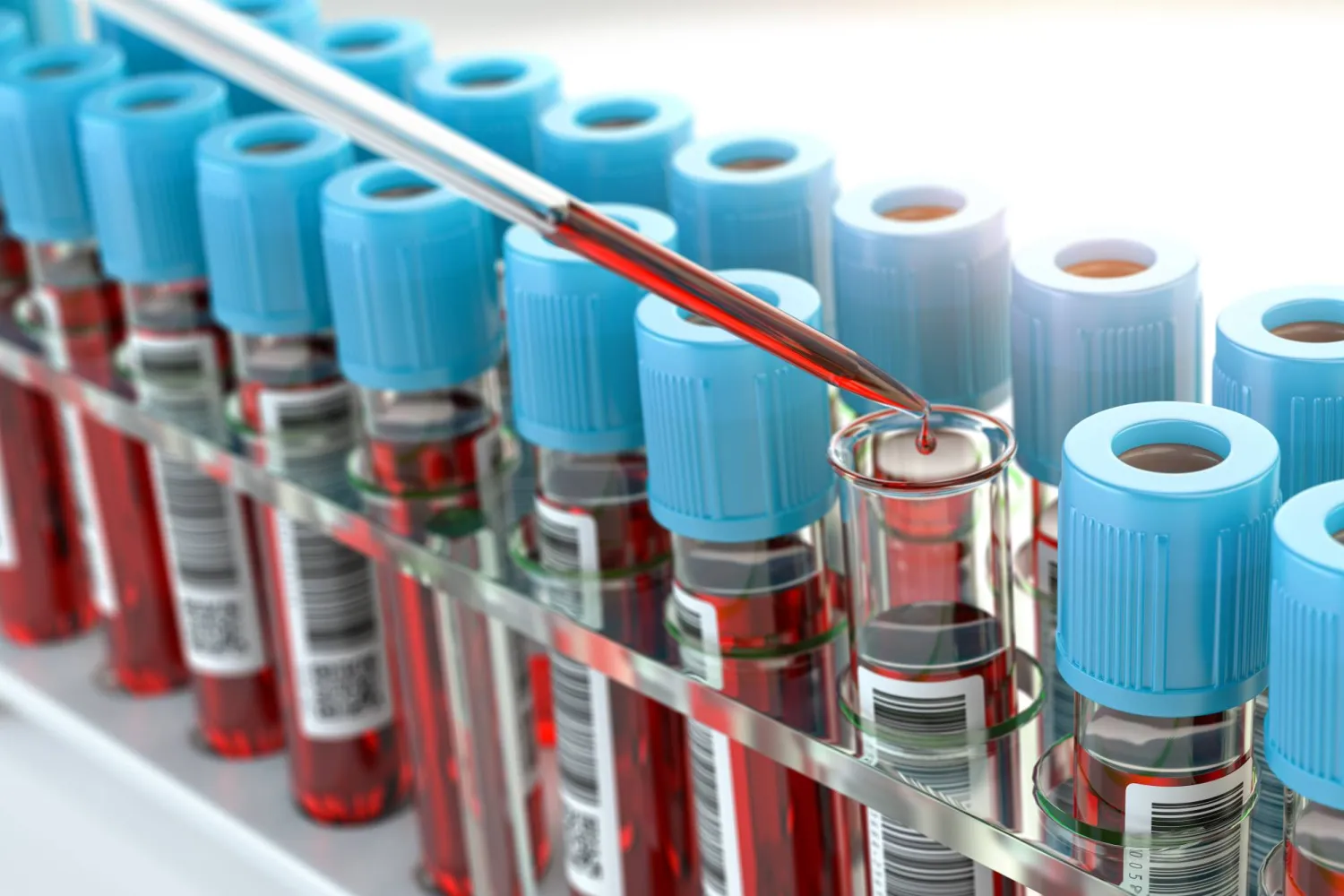 اختبار الدم الشخصي يساعد في تحديد فرص تكرار الإصابة بسرطان الكبد في وقت مبكر لدى مرضى عمليات الزرع (الشرق الأوسط)