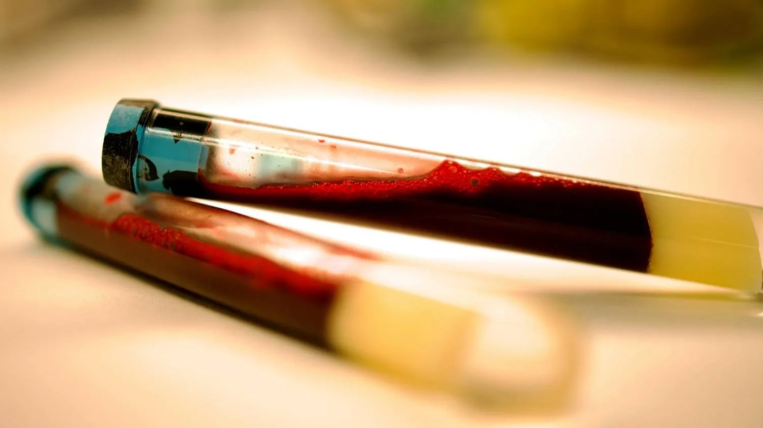 تحديد مؤشرات حيوية لمرض باركنسون يمكن رصدها في الدم (جامعة تشالمرز للتكنولوجيا)