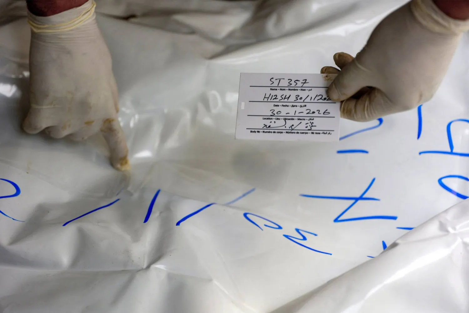 A forensic expert examines one of the bodies of Palestinians returned by Israel the previous day, as part of the Gaza ceasefire deal, in a morgue at al-Shifa hospital in Gaza City on January 30, 2026. (AFP)