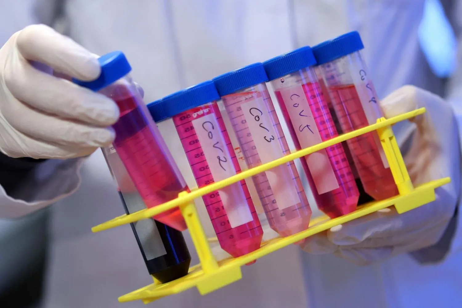 Dr. Monika Brunner-Weinzierl, uzun süreli Kovid-19 örneği işleme sırasında Kovid-19 hücre kültürleri içeren test tüplerini tutuyor. Yeni araştırmalar, uzun süreli Kovid-19 geçiren bazı hastaların, beyin sisi ve bilişsel gerileme de dahil Alzheimer hastalarında görülenlere benzer semptomlar yaşayabileceğini öne sürüyor (AFP)