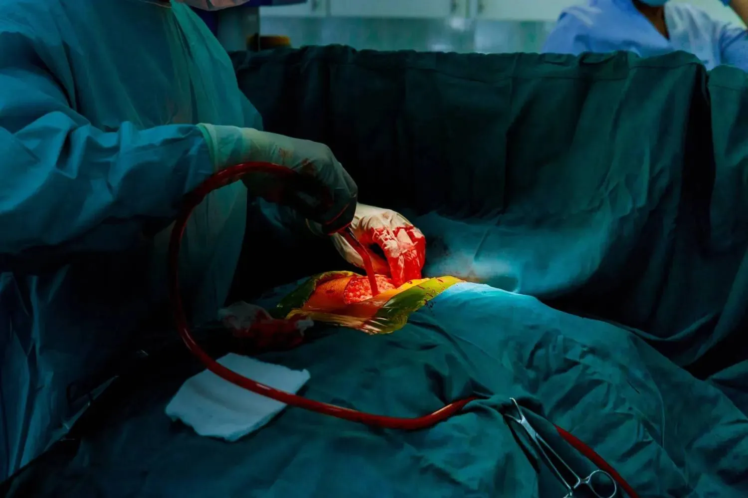 يؤدي العلاج الجديد أيضاً إلى تقليل الآثار الجانبية لجراحة زرع الكُلى (الشرق الأوسط)