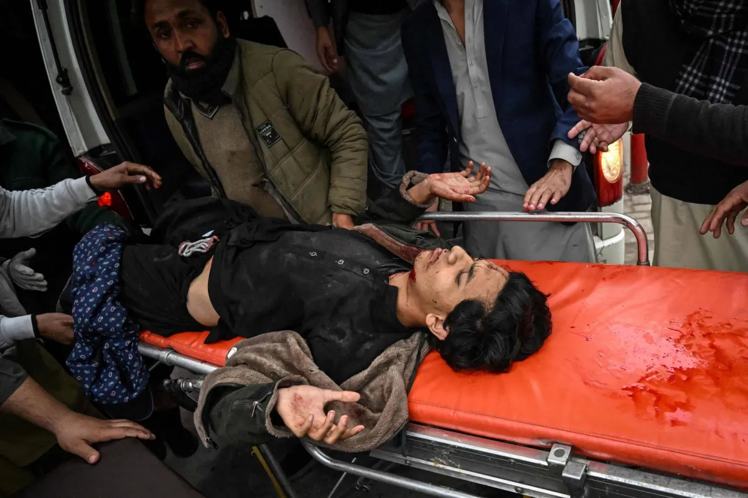 İslamabad'da bir camide bugün meydana gelen patlamada yaralananlardan biri hastaneye götürülüyor (AFP)