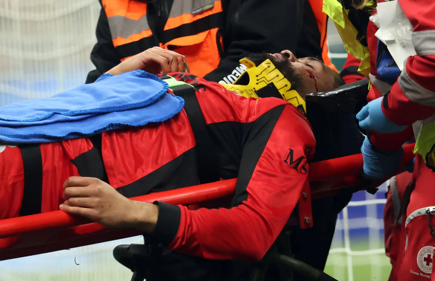 AC Milan's Ruben Loftus-Cheek is carried off the pitch injured during the Italian Serie A soccer match between Milan and Parma in Milan, Italy, 22 February 2026. EPA/MATTEO BAZZI