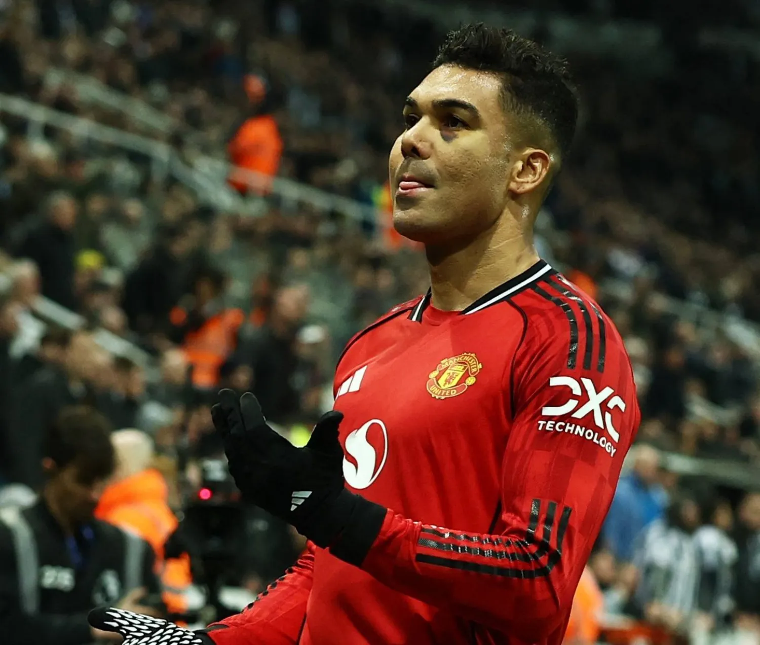 كاسيميرو وتبدو آثار الندبة تحت عينه (رويترز)