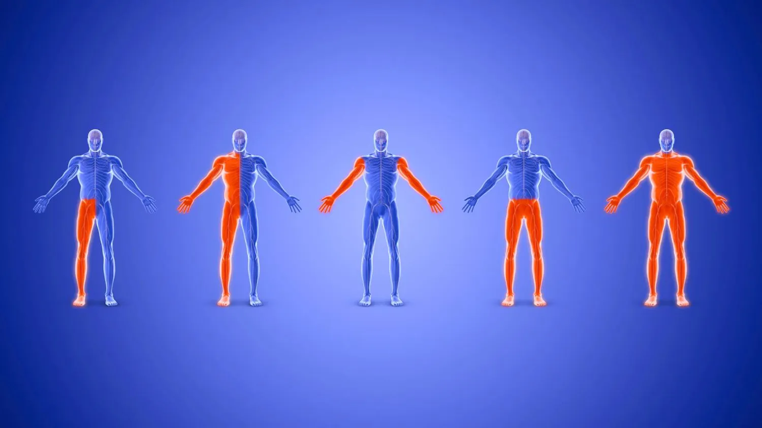 مرونة مفرطة في المفاصل وهشاشة الأنسجة… من أعراض متلازمة إهلرز - دانلوس مفرطة الحركة