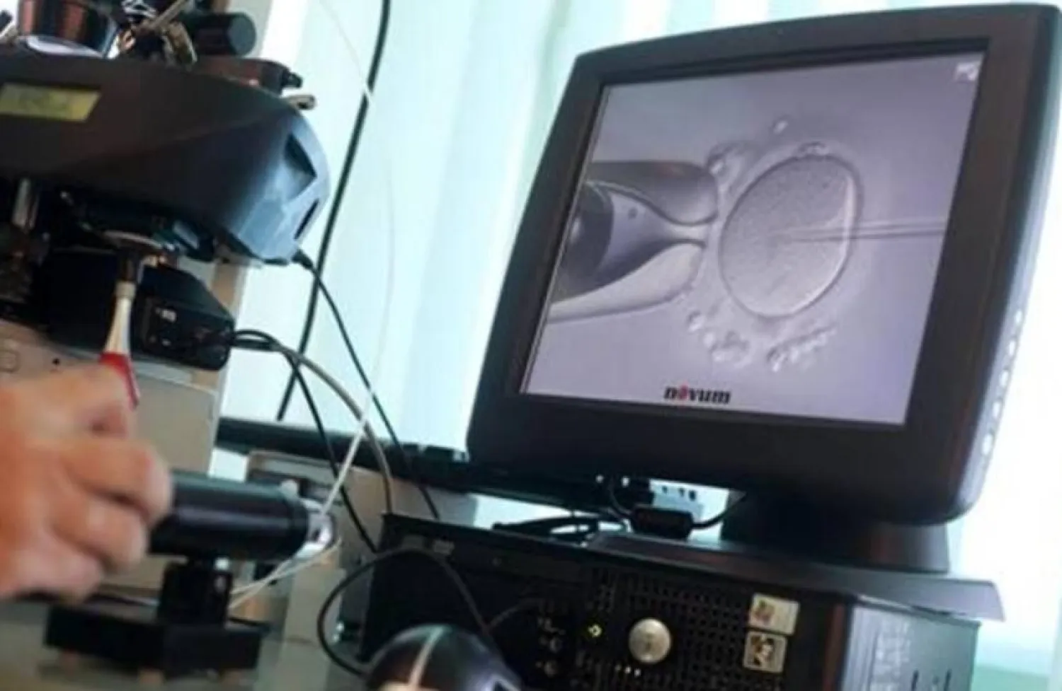 عدد الحيوانات المنوية في الدول الغربية انخفض بنحو 60 % عالمياً منذ عام 1973 (أرشيفية - رويترز)