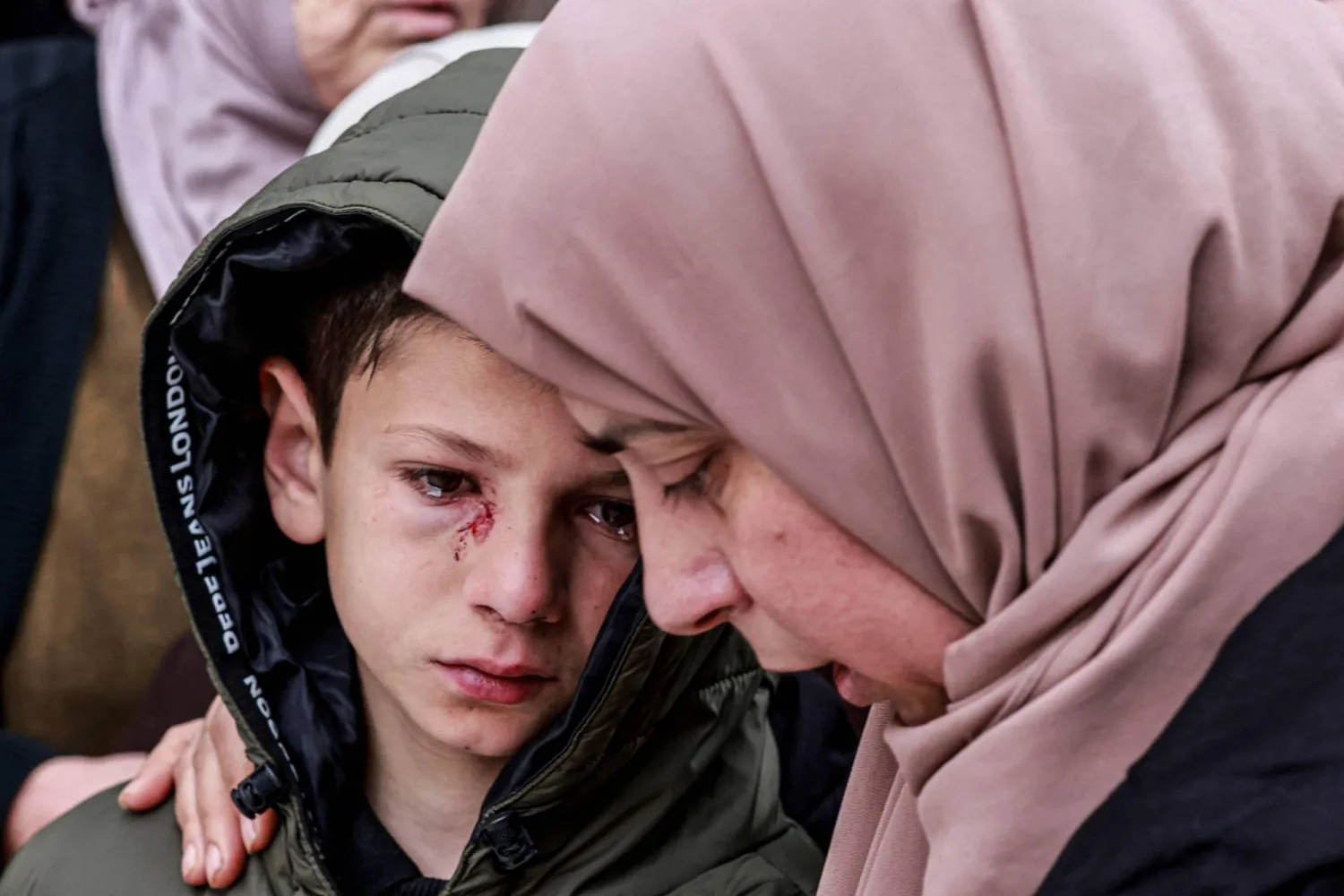 الطفل الفلسطيني مصطفى الذي أصابه جنود إسرائيليون وقتلوا والديه وشقيقيه بعدما هاجموا بالرصاص السيارة التي كانت تقلهم يوم الأحد (أ.ف.ب)