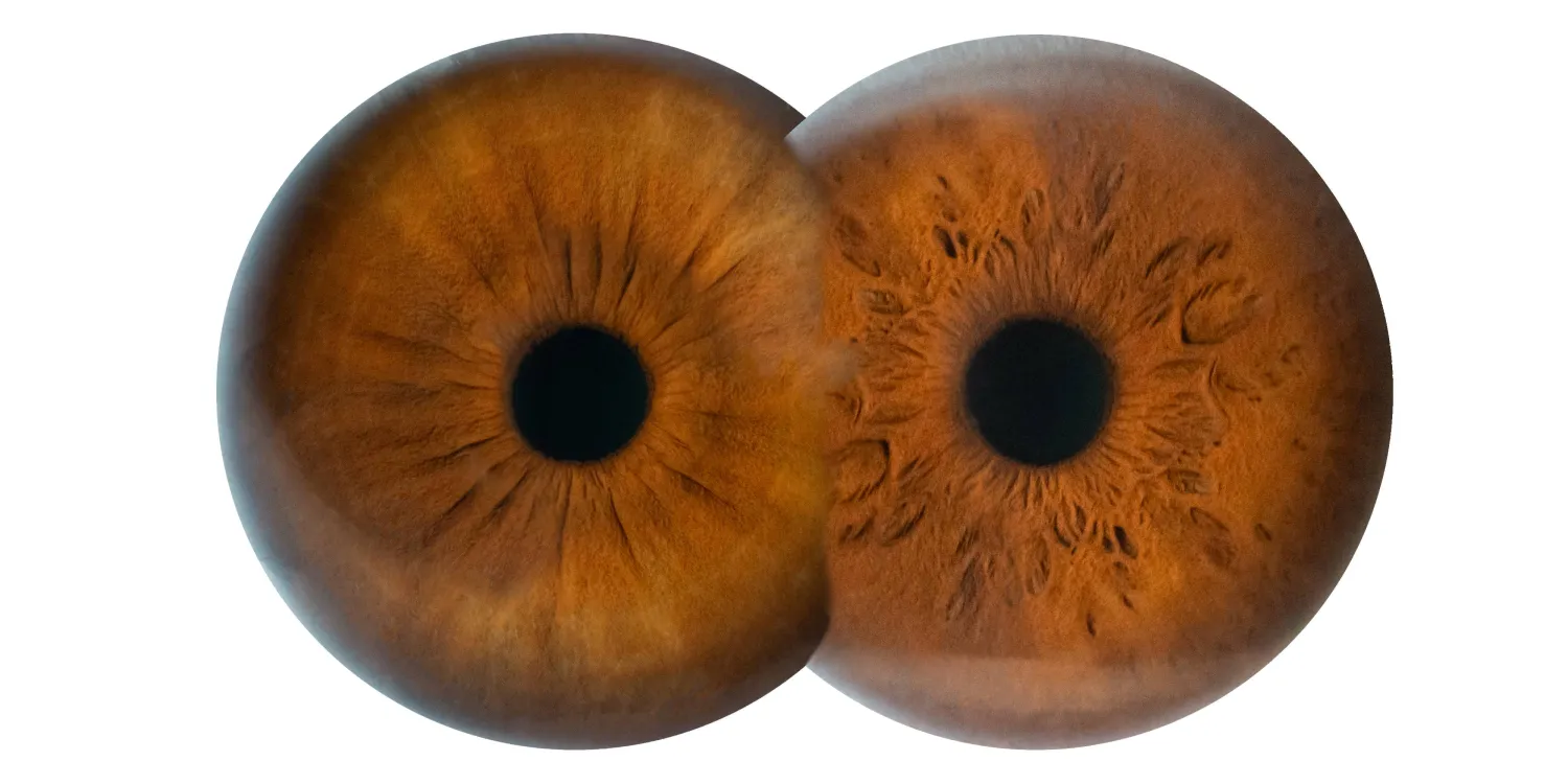 رؤى علمية رائدة لعلاج العمى الوراثي