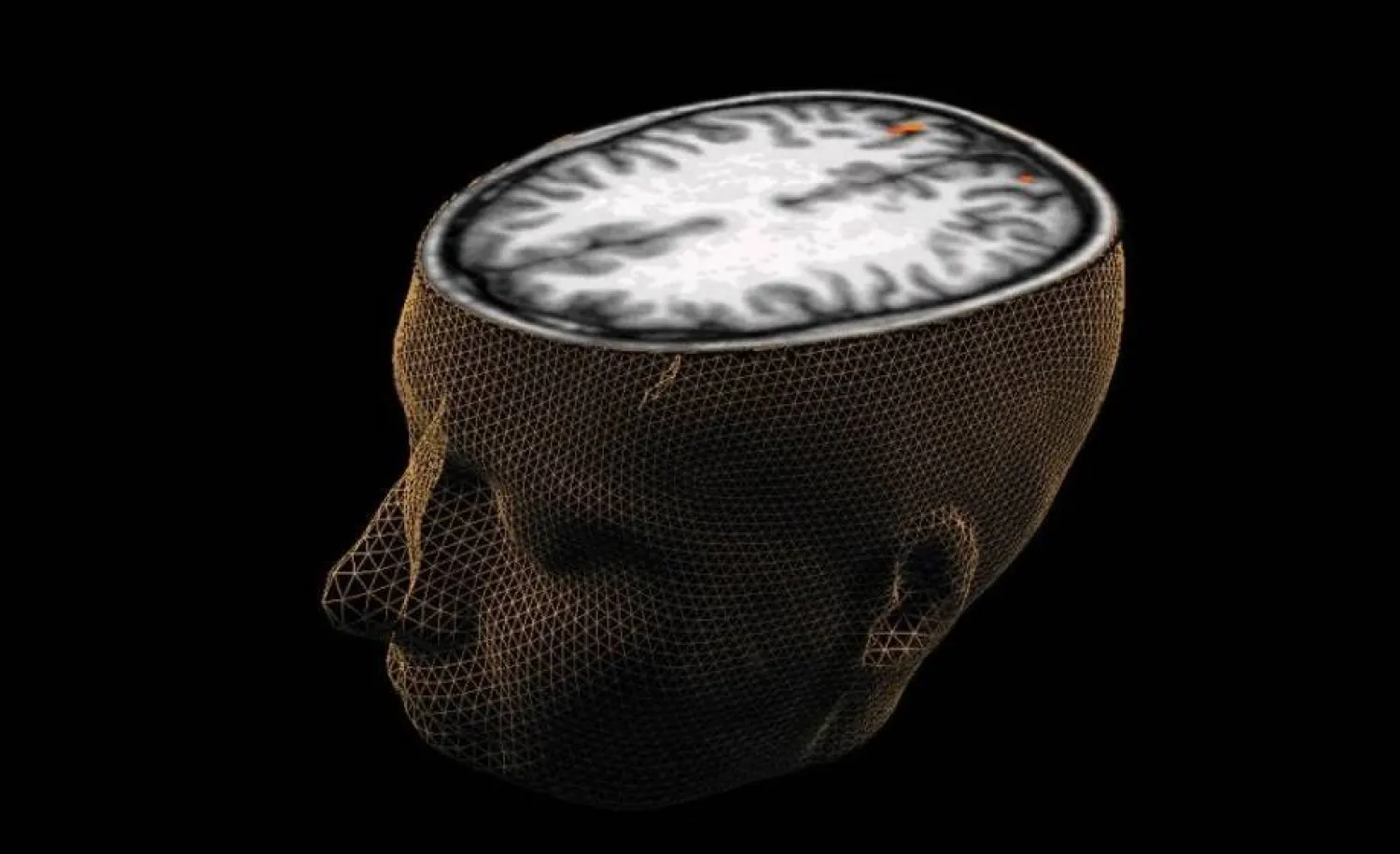 الأدوية المتوفرة حالياً لا تحسن المشكلات الإدراكية مثل التفكير غير المنظم (رويترز)