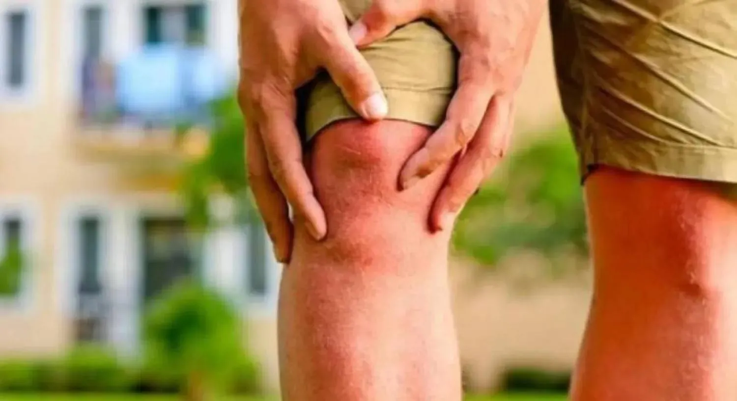 تزيد الدهون المتراكمة في عضلات الفخذ من خطر الإصابة بهشاشة العظام في الركبة (رويترز)