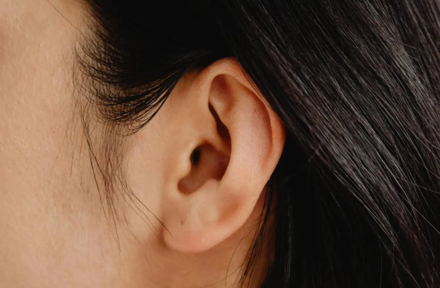 وجد الباحثون أن الورم الكوليسترولي ارتبط بزيادة خطر الإصابة بالخرف بمقدار 1.77 مرة (بكسلز)