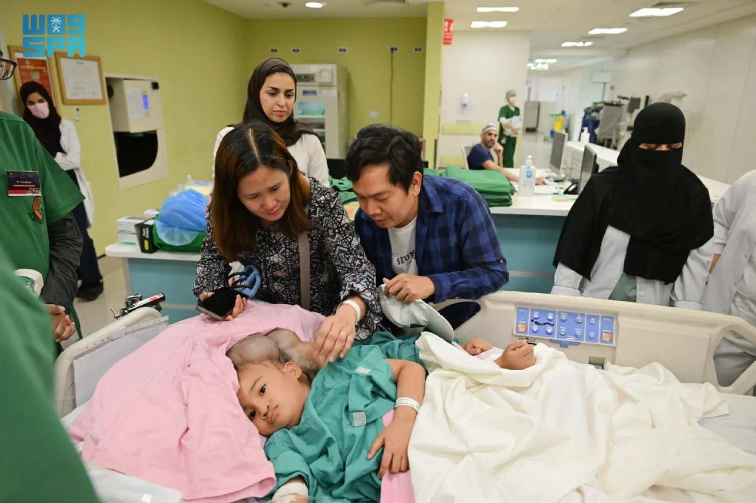 The Filipino conjoined twins (SPA)