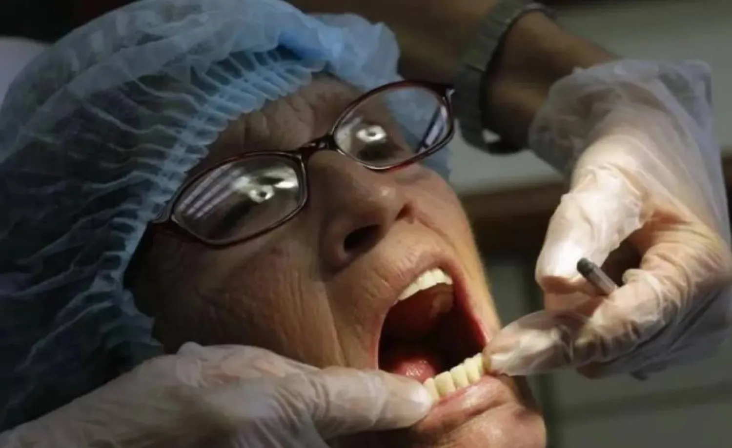 هناك ارتباط قوي بين بكتيريا الفم وسرطان المعدة (رويترز)