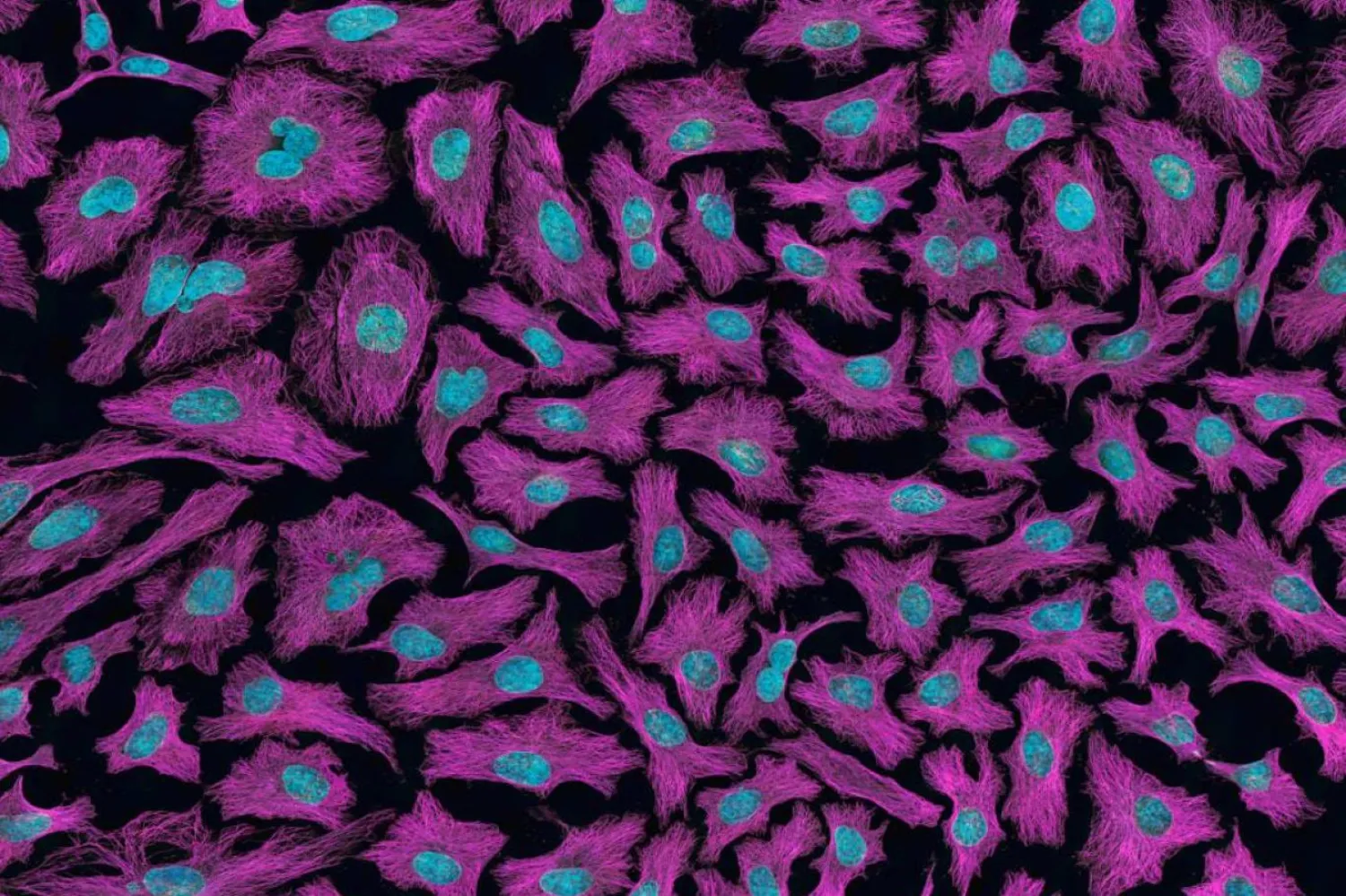 Deney, 6 farklı kanser türünde tümörlerin en az yüzde 30 küçülmesini sağladı (Temsili/Unsplash)