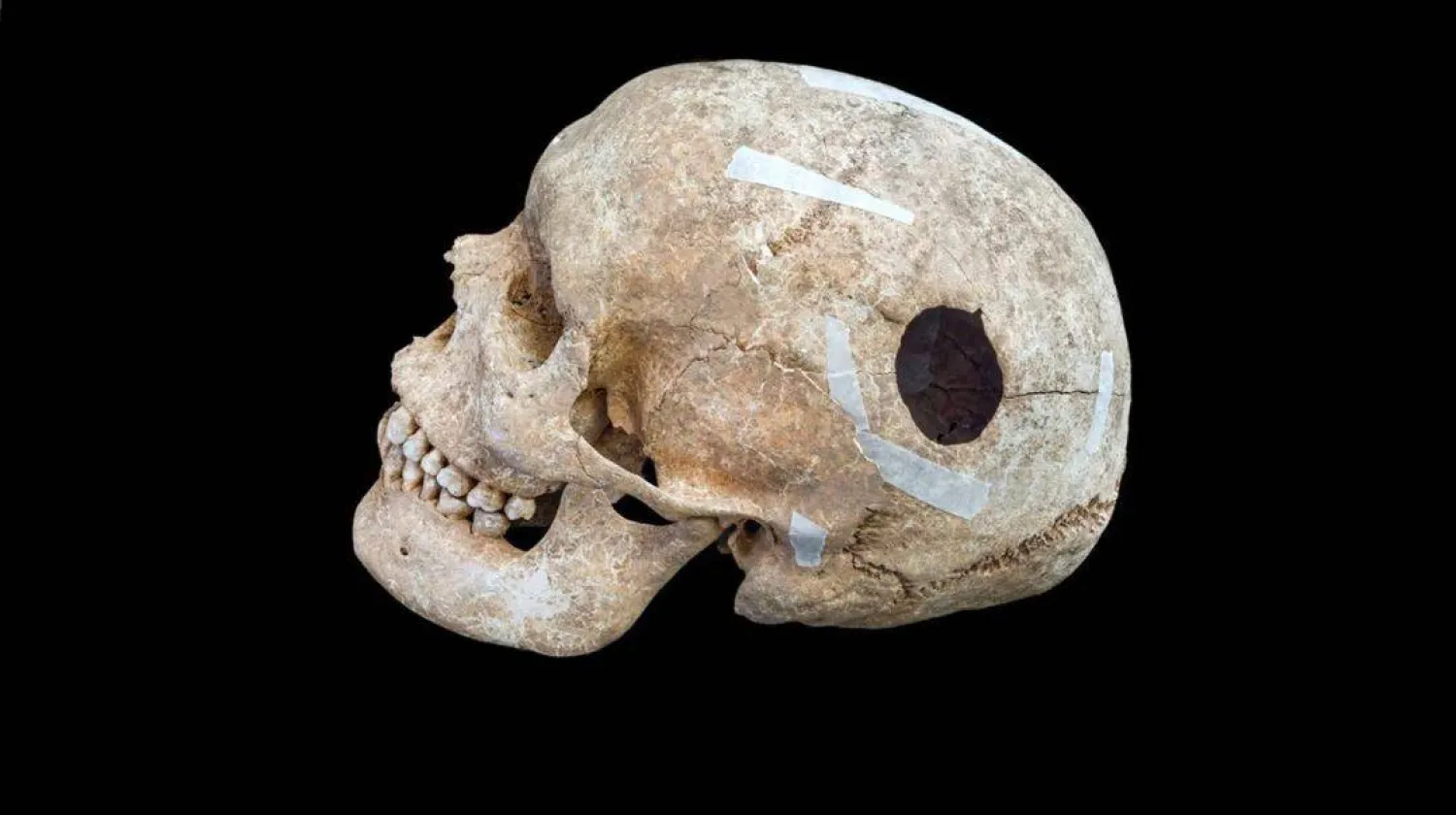 عُثر على جمجمة مثقوبة داخل حصن تل يعود إلى العصر الحديدي في واندلبوري (Cambridge Archaeological Unit)