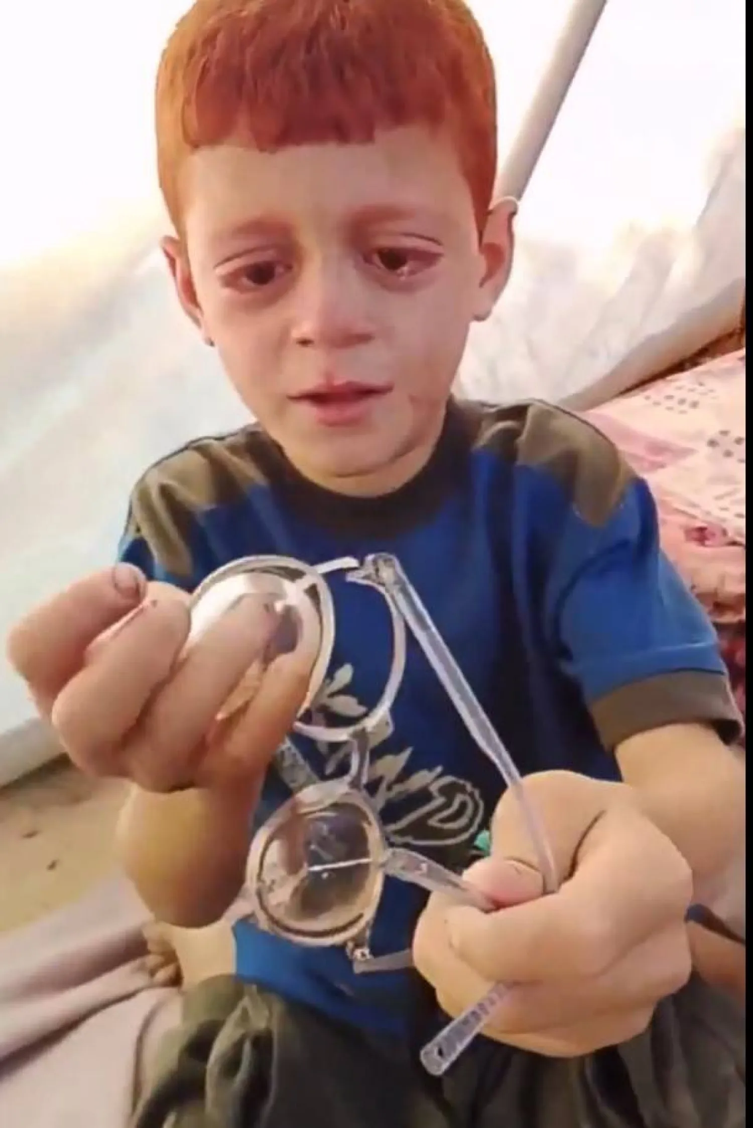 اهتمام عالمي بطفل فلسطيني يعاني من ضعف البصر بكى حزناً على نظارته المكسورة