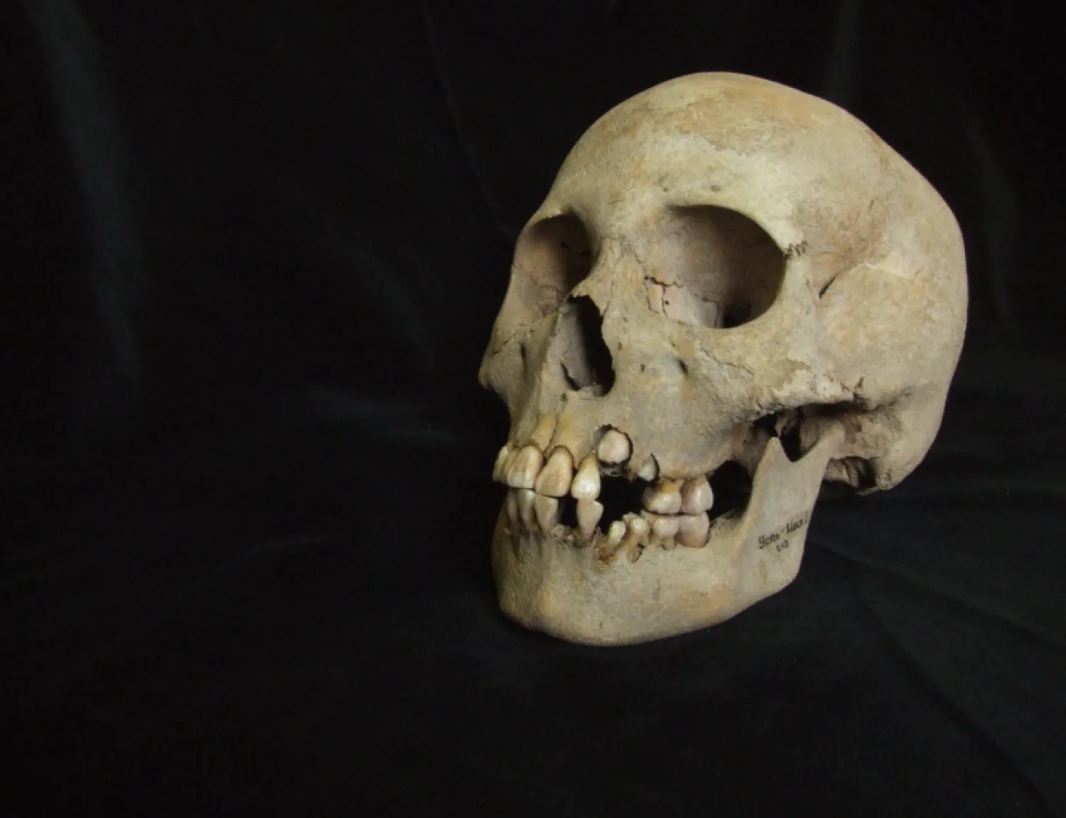 This 2006 image from Angela Lieverse shows the skull of a young girl who was buried with victims of the plague in Siberia. (Angela Lieverse via AP)