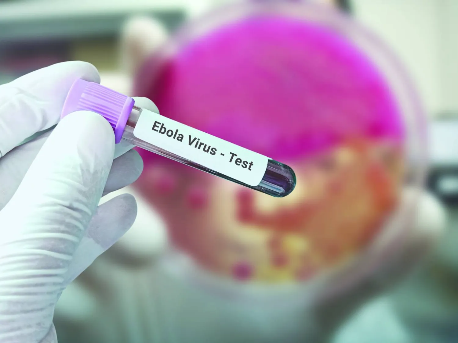 
أنبوبة لاختبار فيروس «إيبولا«