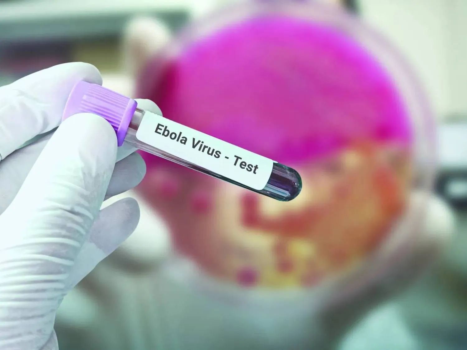 Scientist holds blood sample for Ebola virus test