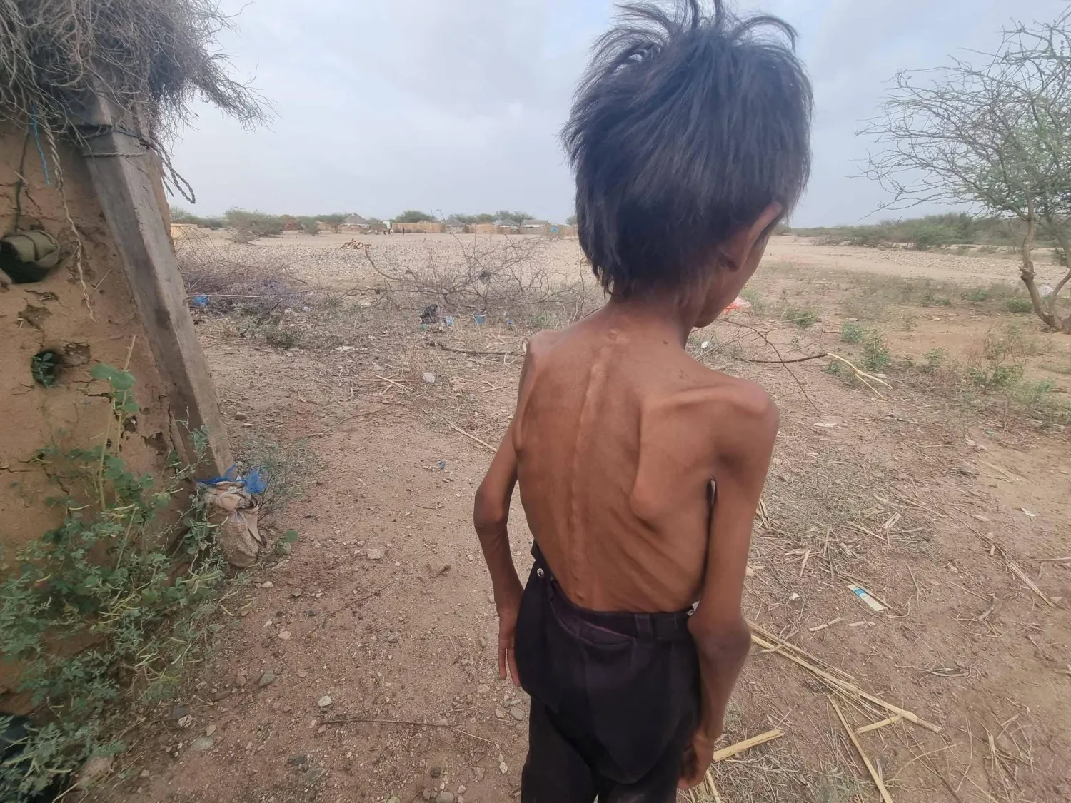مع تسجيل جيوب للمجاعة يحتاج نصف سكان اليمن إلى المساعدات (إعلام محلي)