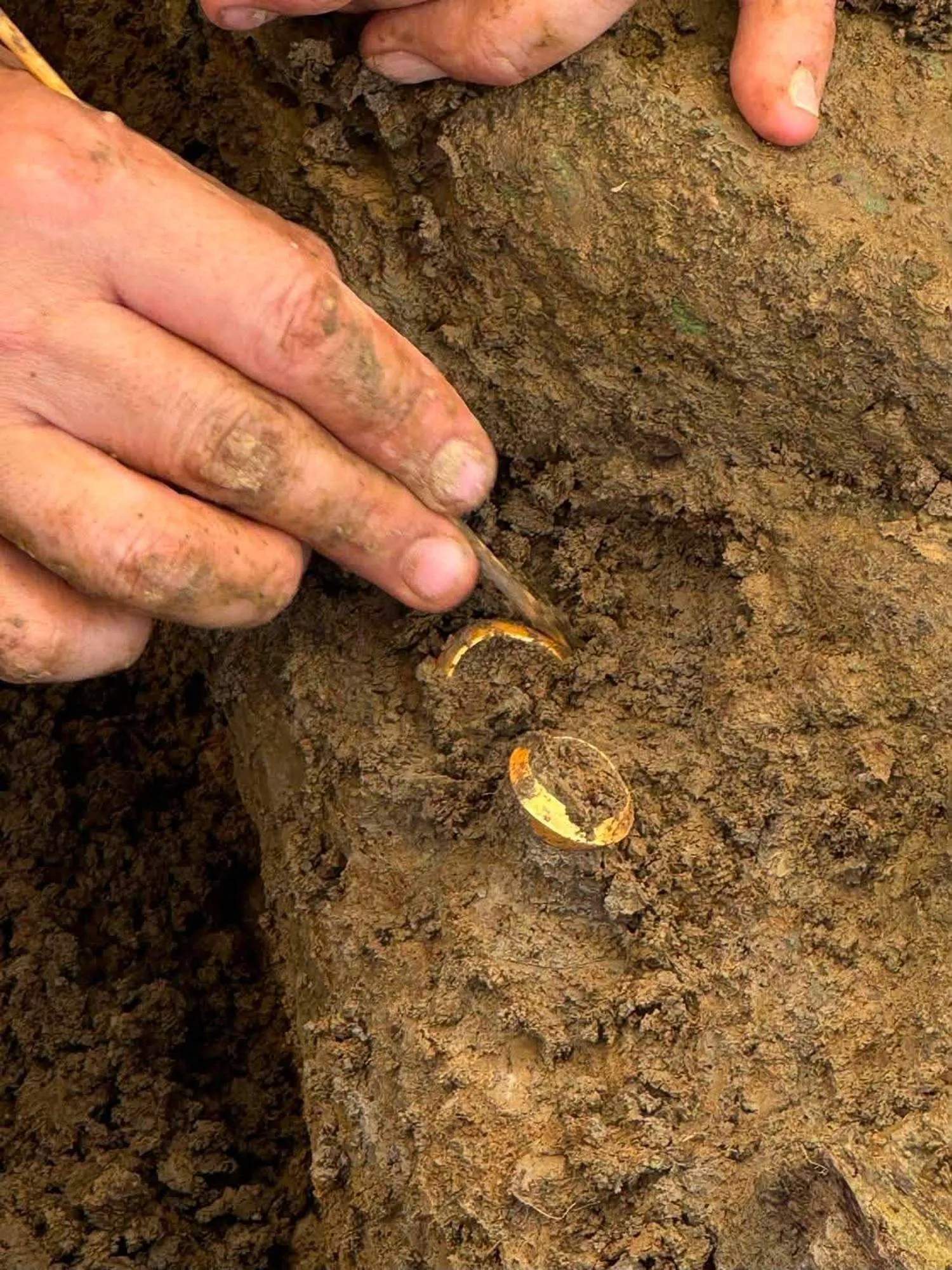In this photo released by The Fine Arts Department, an archaeologist shows two rings with human bones during an ongoing dig at the Don Yai Thong archeological site in Phetchaburi province, Thailand Thursday, July 2, 2026. (The Fine Arts Department via AP)