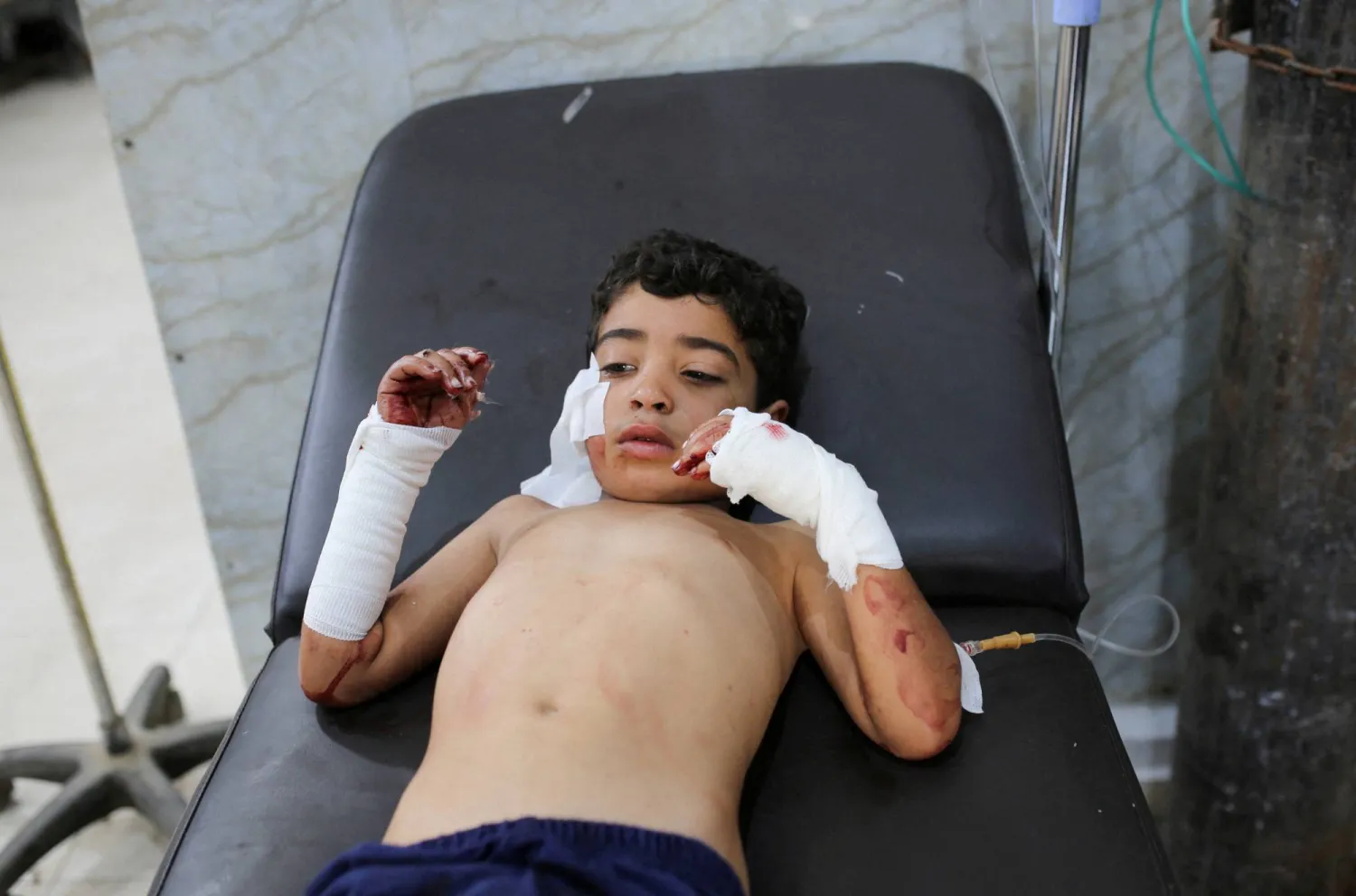 فتى فلسطيني أصيب بجروح جراء غارة إسرائيلية في مخيم النصيرات للاجئين وسط قطاع غزة الجمعة (رويترز)