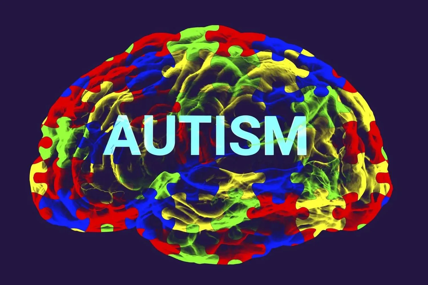 Autism conceptual illustration (Getty)