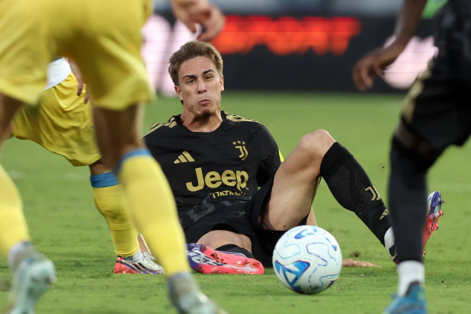 التركي كينان يلدز لاعب اليوفي سقط مصاباً بمواجهة فروزينوني (د.ب.أ)