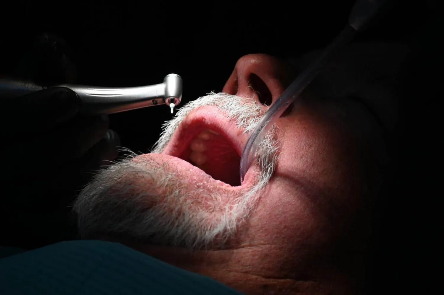 Meksika'nın Los Algodones kasabasındaki Rubio Dental Group muayenehanelerinde bir diş hekimi, Amerikalı bir hastanın dişini tedavi ediyor (AFP)