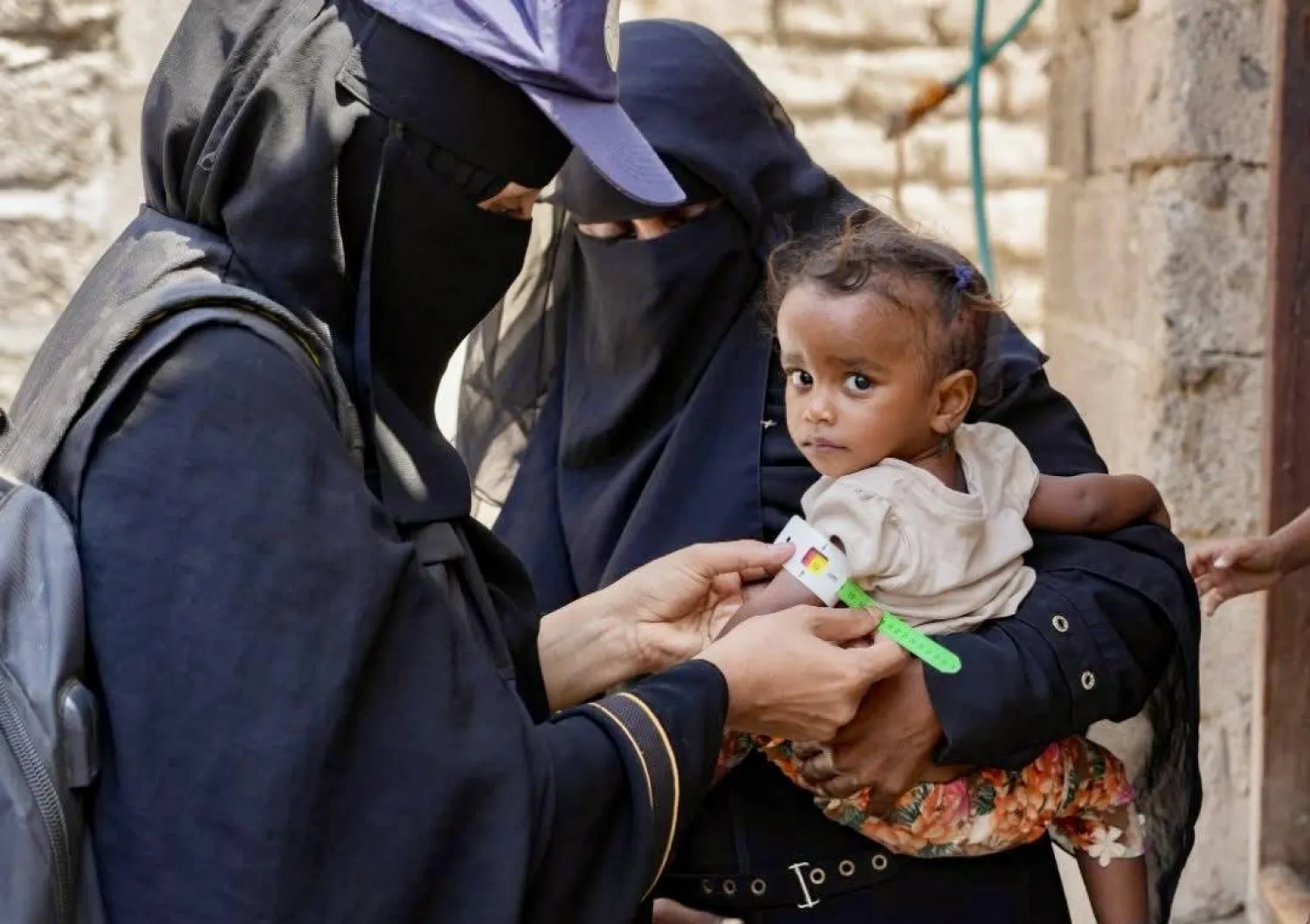 الكثير من النازحين باليمن يحتاجون إلى العلاج في حين أن المرافق الصحية بعيدة عن متناولهم (الأمم المتحدة)