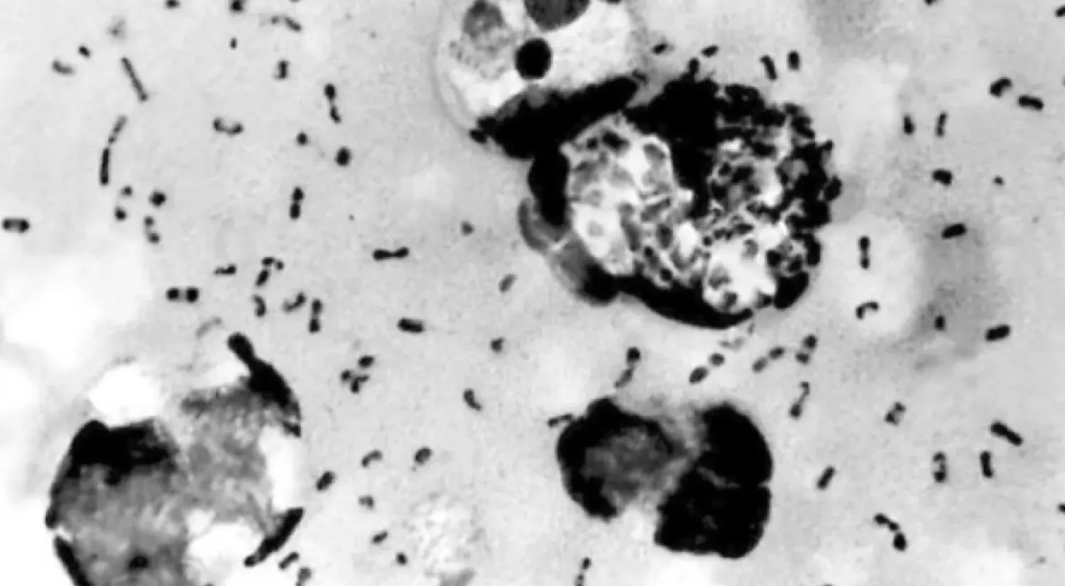 بكتيريا الطاعون «Yersinia pestis» (أ.ف.ب)
