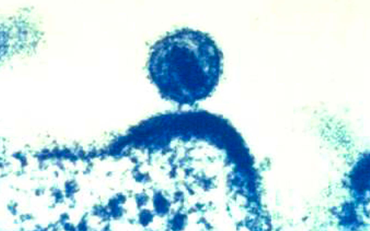 HIV Might be Dormant in Brain, New Study Suggests