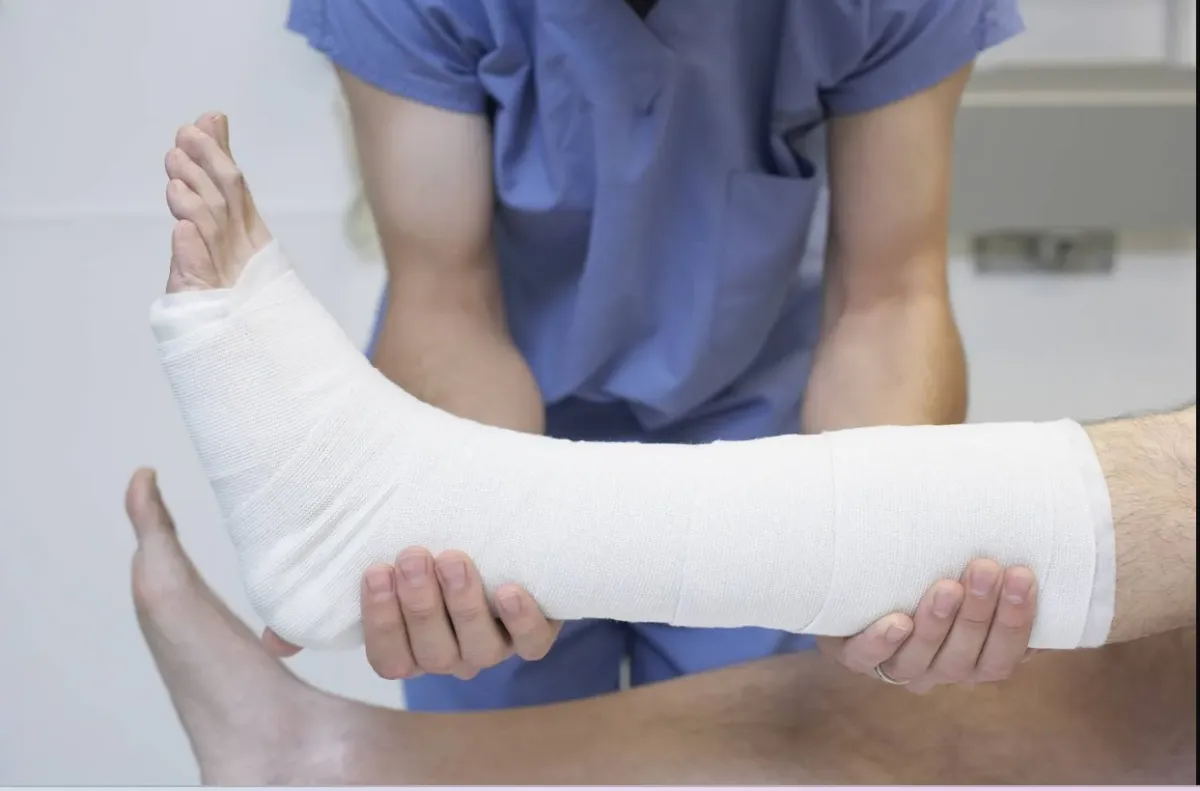 مسدس غراء طبّي يفتح آفاقاً جديدة لعلاج كسور العظام